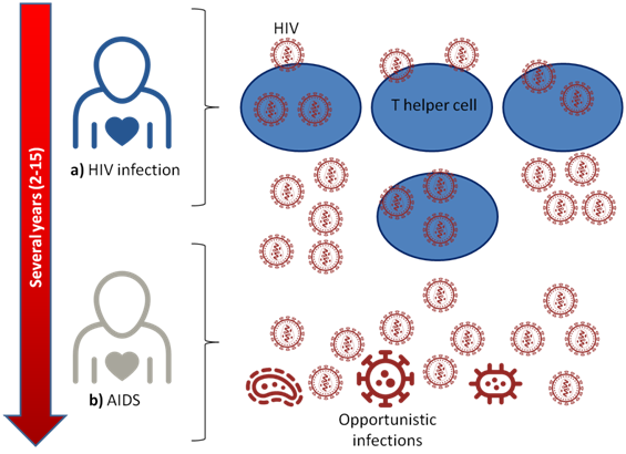 Decline in T helper cell counts over time as HIV progresses to AIDS